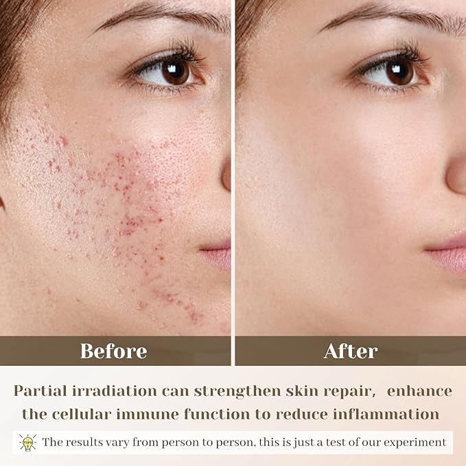 LED Anti-Ageing Face Massager | Electric Gua Sha |