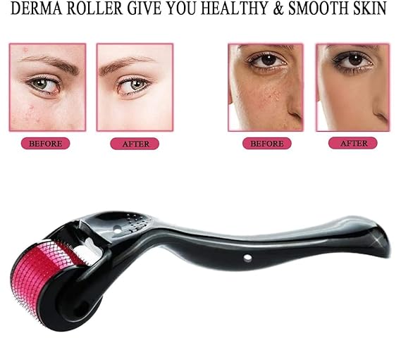 Classic Derma Roller with 540 Titanium Micro Needles